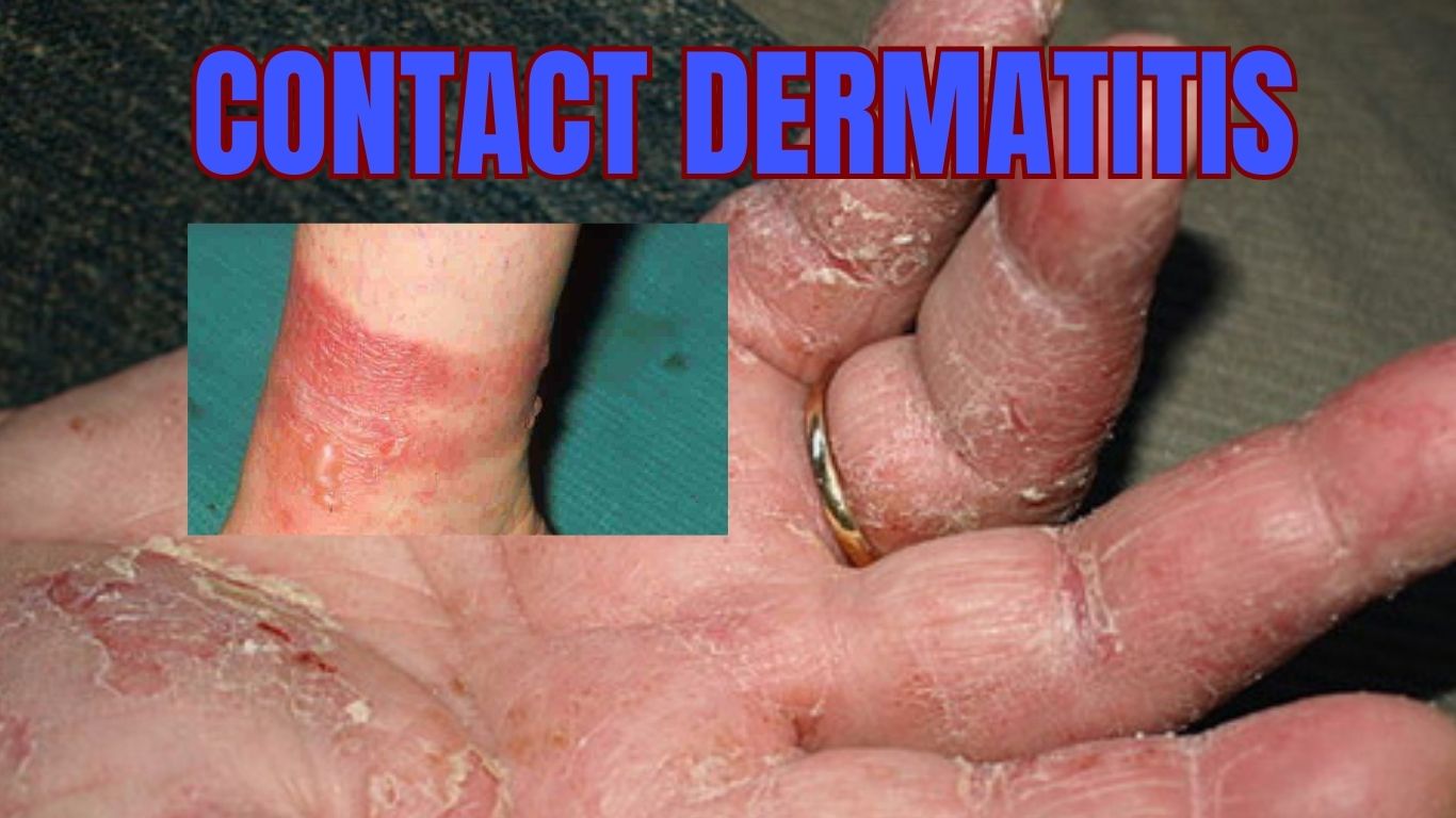 10 Common Skin Disease You need to know JAYYUSH HOSPITAL