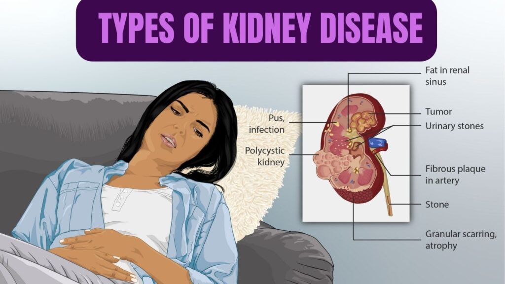 Kidney Disease - What is it and How to prevent - JAYYUSH HOSPITAL