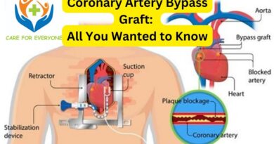 Coronary Artery Bypass Graft: All You Wanted to Know
